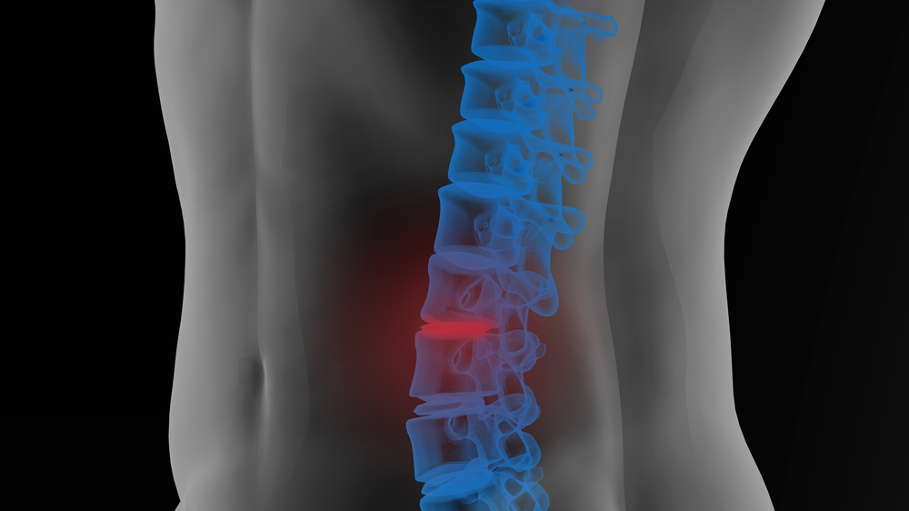 Back-Pain-After-Car-Accident-South-Hill-WA